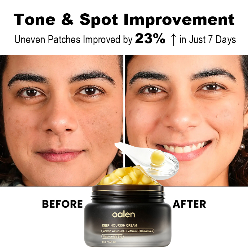 Oalen Private Label Liposome Vitamin c PDRN Golden Capsule Facial Cream Brighten Dull Skin Hydrating Glow Gel Moisturizer,MY SHOP