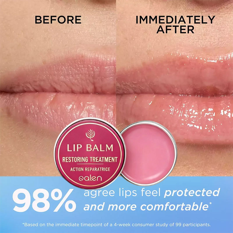 Private Label SPF 15 Moisturizing Treatment Lip Balm Soothing Repair Deep Hydration Sun Protection Daily Lip Care Lip Balm,MY SHOP