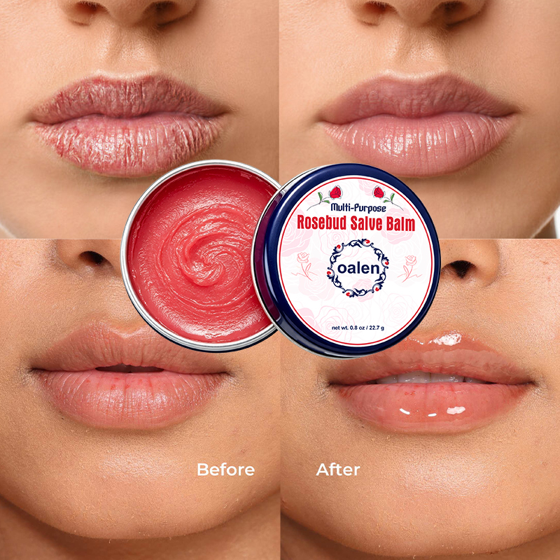 Oalen Private Label Multi Purpose Rosebud Salve Balm Lip Therapy Tin Lip Balm Moisturizing Soothing Lip Care for Dry Chapped Lip,oalen cosmetics
