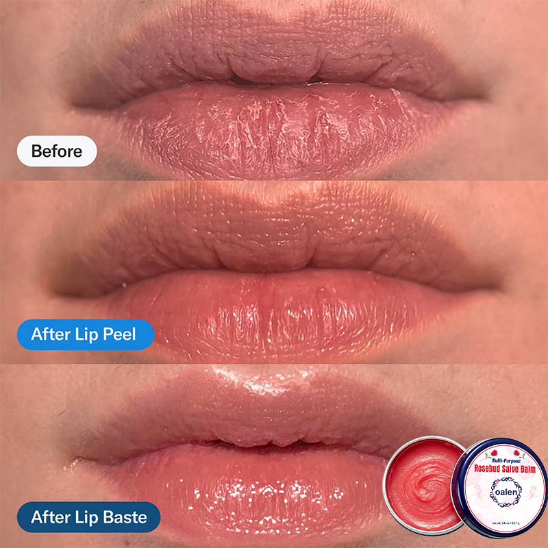 Oalen Private Label Multi Purpose Rosebud Salve Balm Lip Therapy Tin Lip Balm Moisturizing Soothing Lip Care for Dry Chapped Lip,oalen cosmetics