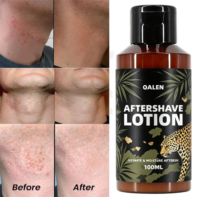Manufacturer Wholesale 100ML Private Label Moisturizing and Nourishing Mens After Shave Lotion Soothe Irritation Reduce Redness,MY SHOP