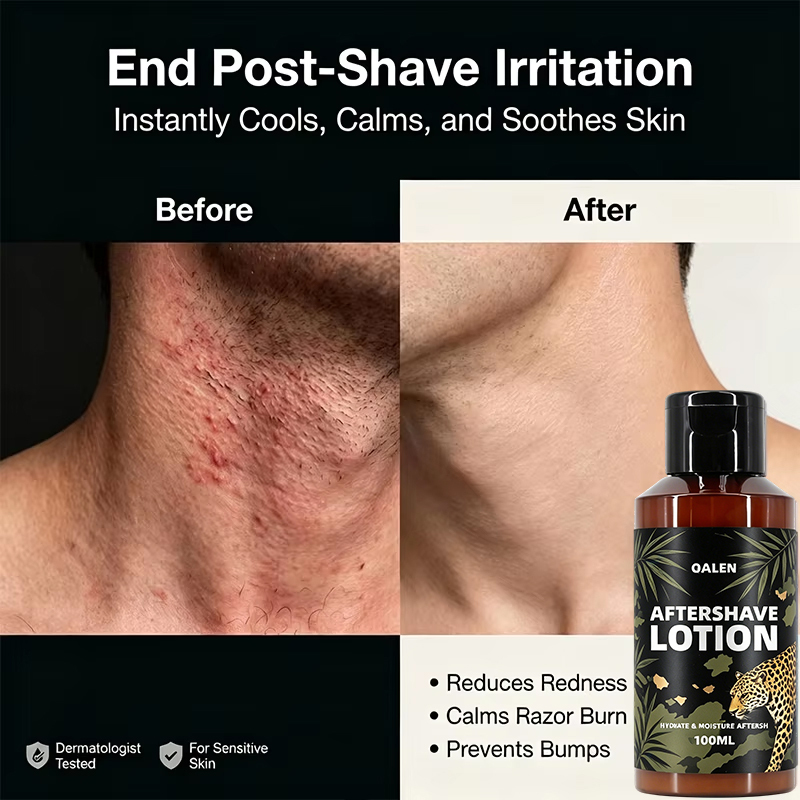 Manufacturer Wholesale 100ML Private Label Moisturizing and Nourishing Mens After Shave Lotion Soothe Irritation Reduce Redness,MY SHOP