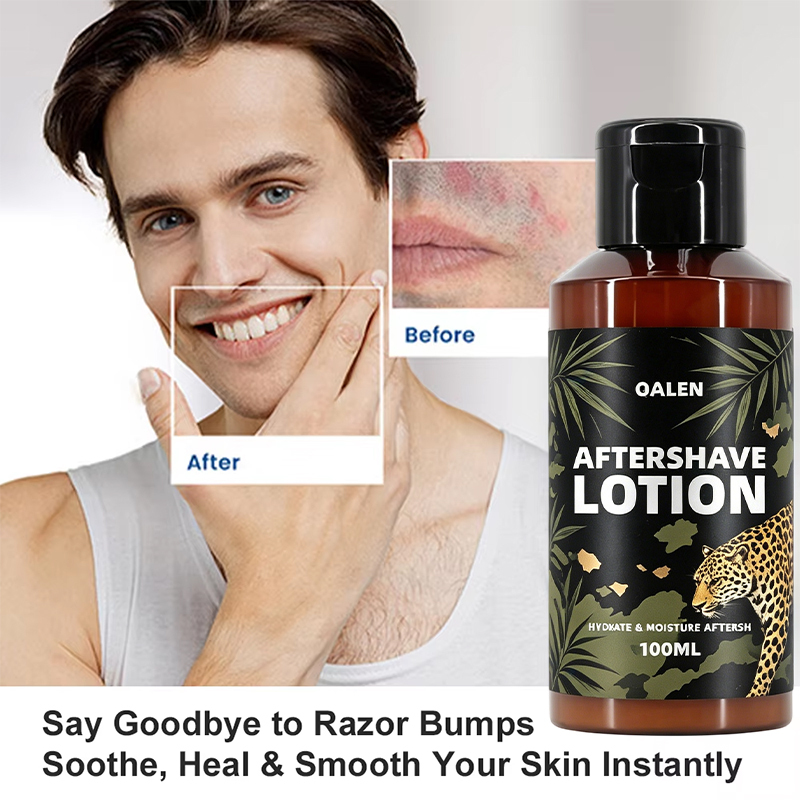 Manufacturer Wholesale 100ML Private Label Moisturizing and Nourishing Mens After Shave Lotion Soothe Irritation Reduce Redness,MY SHOP