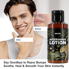 Manufacturer Wholesale 100ML Private Label Moisturizing and Nourishing Mens After Shave Lotion Soothe Irritation Reduce Redness,MY SHOP