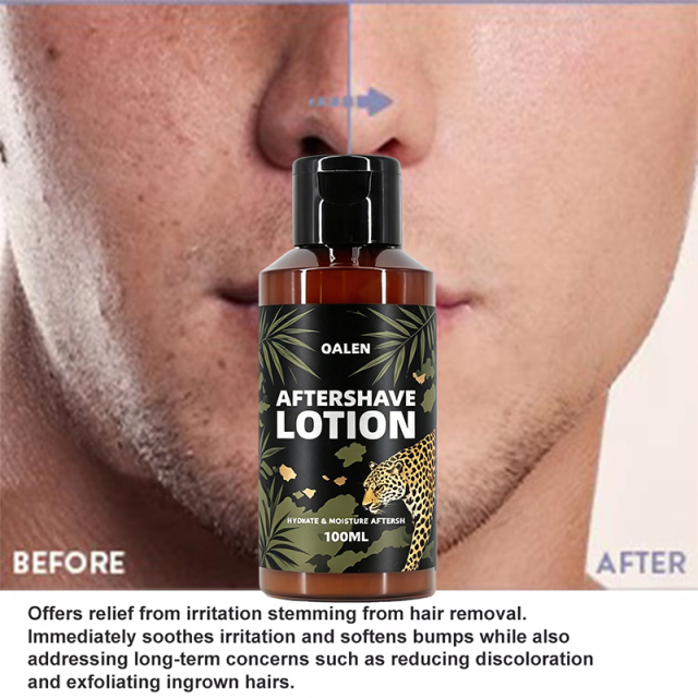 Manufacturer Wholesale 100ML Private Label Moisturizing and Nourishing Mens After Shave Lotion Soothe Irritation Reduce Redness,MY SHOP