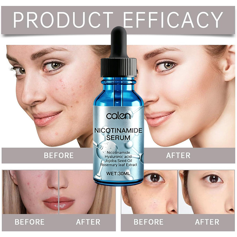 Niacinamide Serum 10% Niacinamide 1% Zinc Serum With Private Labels for OEM Service Minimize Pores Control Oil Reduce Blemishes,oalen cosmetics