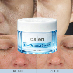 Oalen Private Label Citrus Mint Ice Facial Sorbet Serum Vitamin c Centella Soothe Redness Balance Oil Mild Skincare,oalen cosmetics
