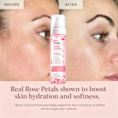 Luxfume Private Label Rose Petal Toner Spray Deep Hydrating Soothe Dry Skin Improve Uneven Dull Damaged Facial Texture,oalen cosmetics