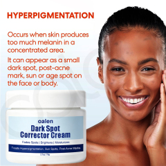 Luxfume Private Label Remove Dark Spot Cream Fade Blemish Marks Brighten Dull Skin Moisturizing Soothing Facial Care,oalen cosmetics