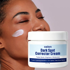 Luxfume Private Label Remove Dark Spot Cream Fade Blemish Marks Brighten Dull Skin Moisturizing Soothing Facial Care,oalen cosmetics