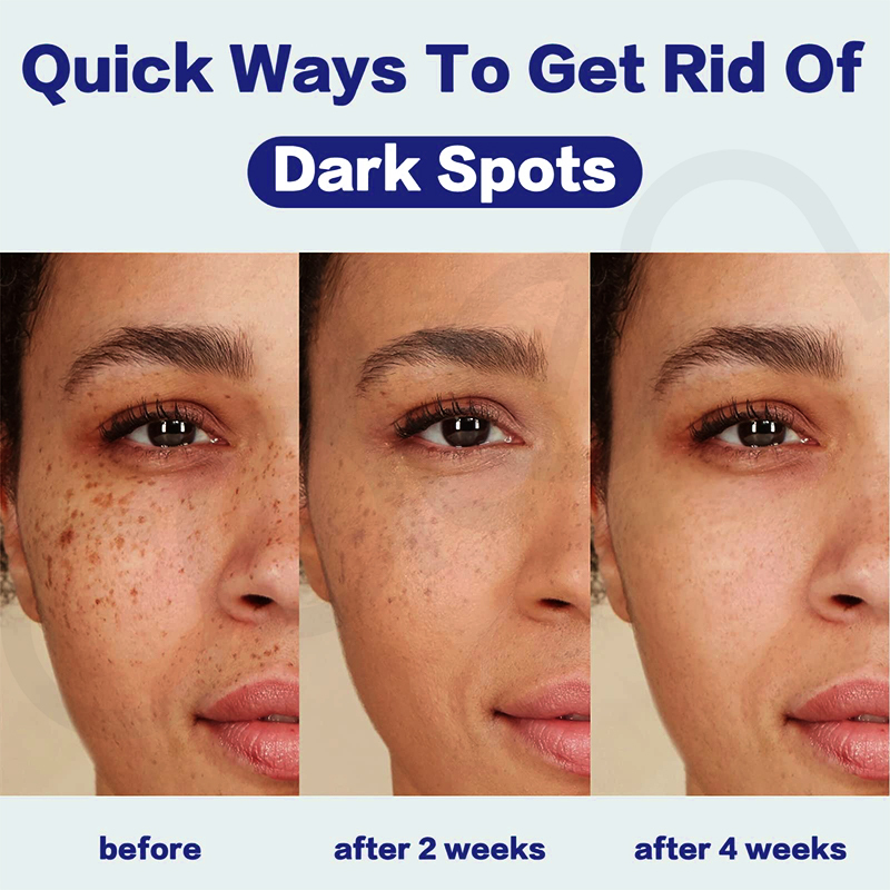 Luxfume Private Label Remove Dark Spot Cream Fade Blemish Marks Brighten Dull Skin Moisturizing Soothing Facial Care,oalen cosmetics