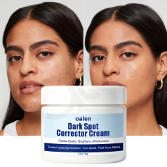 Luxfume Private Label Remove Dark Spot Cream Fade Blemish Marks Brighten Dull Skin Moisturizing Soothing Facial Care,oalen cosmetics