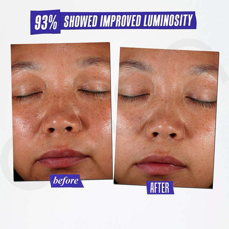 Luxfume Private Label Remove Dark Spot Cream Fade Blemish Marks Brighten Dull Skin Moisturizing Soothing Facial Care,oalen cosmetics