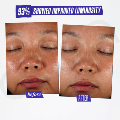 Luxfume Private Label Remove Dark Spot Cream Fade Blemish Marks Brighten Dull Skin Moisturizing Soothing Facial Care,oalen cosmetics