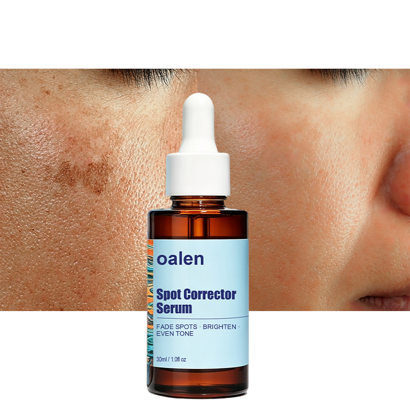Luxfume Private Label Remove Dark Spot Serum Fade Blemish Discoloration Brighten Dull Complexion Soothe Moisturize Facial Skin,oalen cosmetics