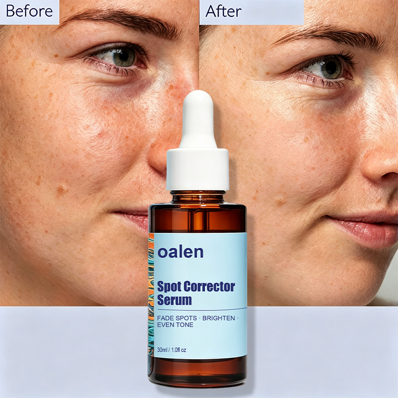 Luxfume Private Label Remove Dark Spot Serum Fade Blemish Discoloration Brighten Dull Complexion Soothe Moisturize Facial Skin,oalen cosmetics
