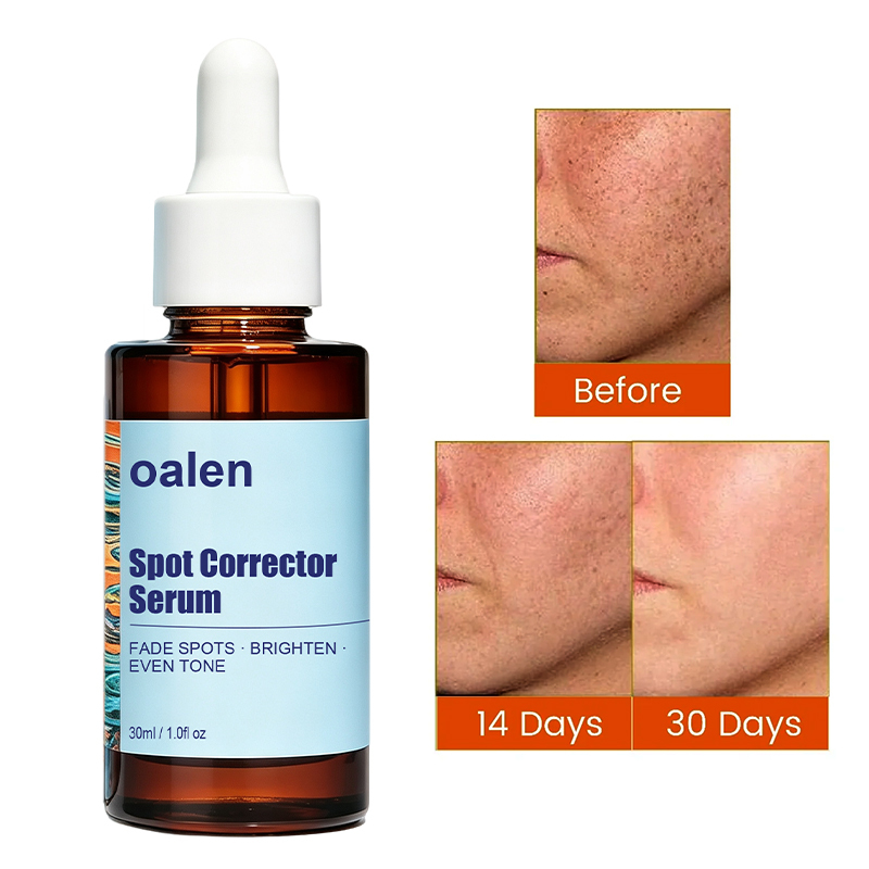 Luxfume Private Label Remove Dark Spot Serum Fade Blemish Discoloration Brighten Dull Complexion Soothe Moisturize Facial Skin,oalen cosmetics
