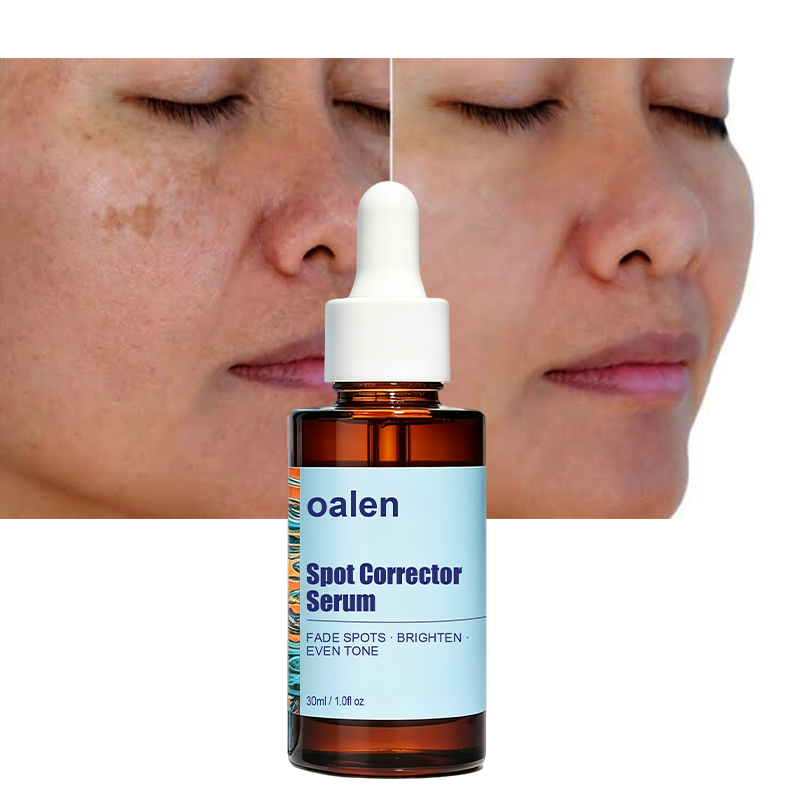 Oalen Private Label Remove Dark Spot Serum Fade Sun Spots Post Acne Marks Brighten Nourish Rejuvenate Repair Soothe Facial Skin,MY SHOP