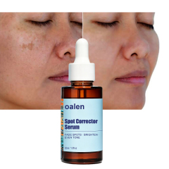 Oalen Private Label Remove Dark Spot Serum Fade Sun Spots Post Acne Marks Brighten Nourish Rejuvenate Repair Soothe Facial Skin,MY SHOP