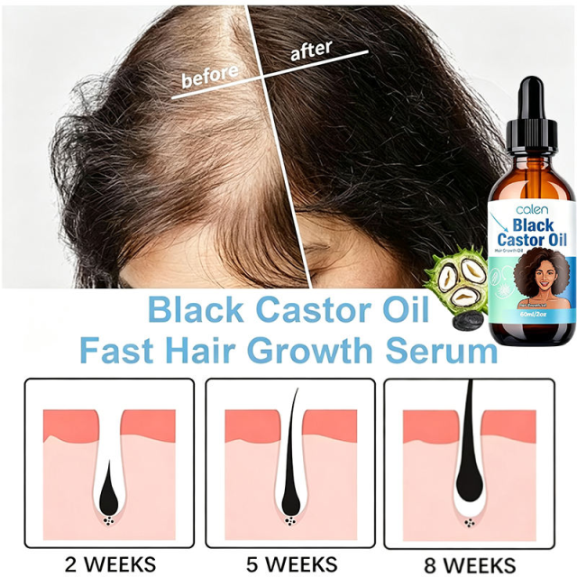 Luxfume 60Ml Private Label Natural African Black Women Biotin Regrowth Serum Castor Hair Growth Oil Castor Oil Nourish Scalp,MY SHOP