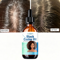 Luxfume 60Ml Private Label Natural African Black Women Biotin Regrowth Serum Castor Hair Growth Oil Castor Oil Nourish Scalp,MY SHOP