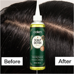 Oalen Custom Logo Pre-Shampoo Scalp Oily Control Soothing Scalp Relief Scalp Detox Pores Remove Buildup Refresh Irritated Scalp,oalen cosmetics