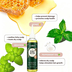 Oalen Custom Logo Pre-Shampoo Scalp Oily Control Soothing Scalp Relief Scalp Detox Pores Remove Buildup Refresh Irritated Scalp,oalen cosmetics
