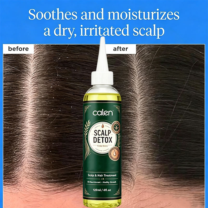 Oalen Custom Logo Pre-Shampoo Scalp Oily Control Soothing Scalp Relief Scalp Detox Pores Remove Buildup Refresh Irritated Scalp,oalen cosmetics