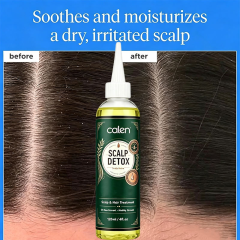 Oalen Custom Logo Pre-Shampoo Scalp Oily Control Soothing Scalp Relief Scalp Detox Pores Remove Buildup Refresh Irritated Scalp,oalen cosmetics