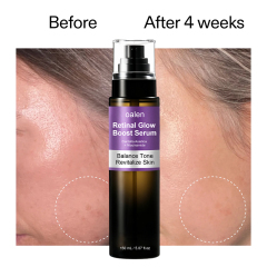Oalen Private Label Hydrating Retinal Face Body Serum With Retinaldehyde Niacinamide and Cica Improve Dull and Uneven Skin,oalen cosmetics