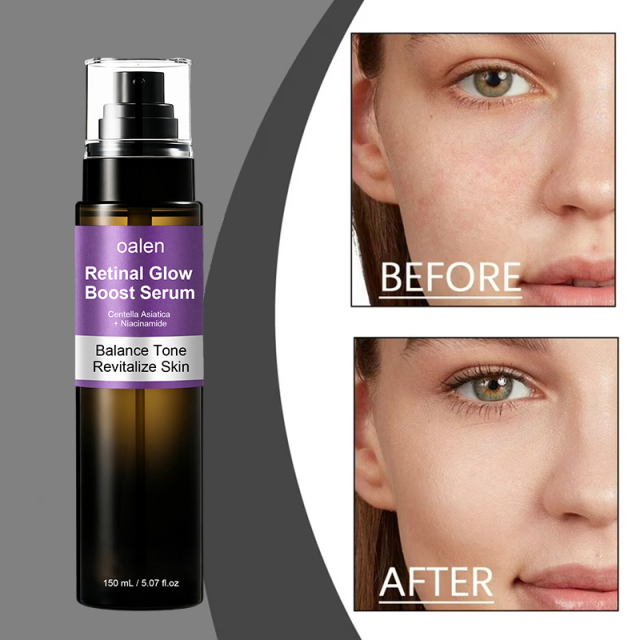 Oalen Private Label Hydrating Retinal Face Body Serum With Retinaldehyde Niacinamide and Cica Improve Dull and Uneven Skin,oalen cosmetics