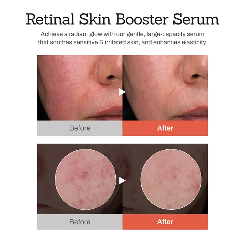 Oalen Private Label Hydrating Retinal Face Body Serum With Retinaldehyde Niacinamide and Cica Improve Dull and Uneven Skin,oalen cosmetics