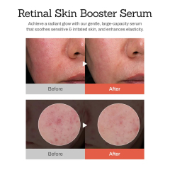 Oalen Private Label Hydrating Retinal Face Body Serum With Retinaldehyde Niacinamide and Cica Improve Dull and Uneven Skin,oalen cosmetics