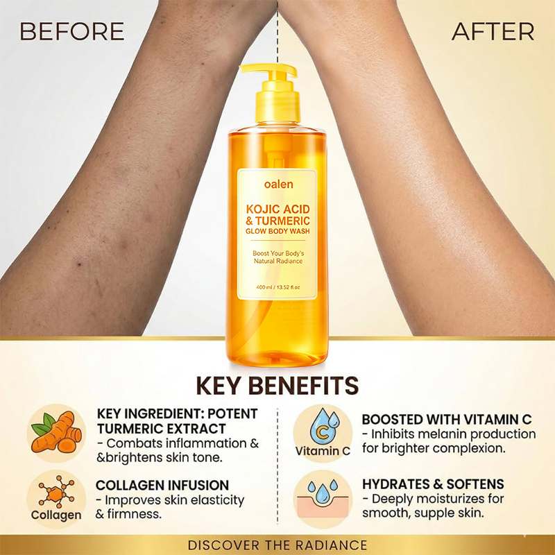Oalen Private Label Turmeric Kojic Acid Body Wash Gentle Shower Gel Infused With Niacinamide Vitamin C Improve Uneven Skin Tone,oalen cosmetics