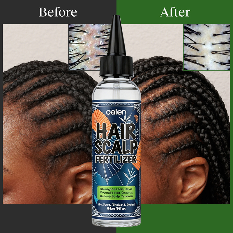 Oalen Private Label Braid Care Hair Kit Scalp Oil Braid Sheen Spray Braid Gel for Box Braids and Twists Hairstyles,MY SHOP