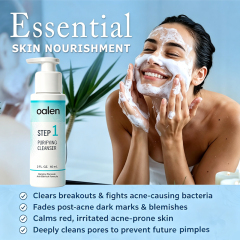 Oalen Private Label 3 Step Acne Care Kit Facial Acne Treatment Set Exfoliating Toner Spot Care 30 Day Complete Facial Skin Care,oalen cosmetics