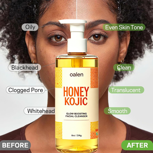 Oalen Private Label Honey Kojic Glow Boosting Facial Cleanser Remove Blackheads clear Blemishes Brighten Dull Skin Face Wash,MY SHOP