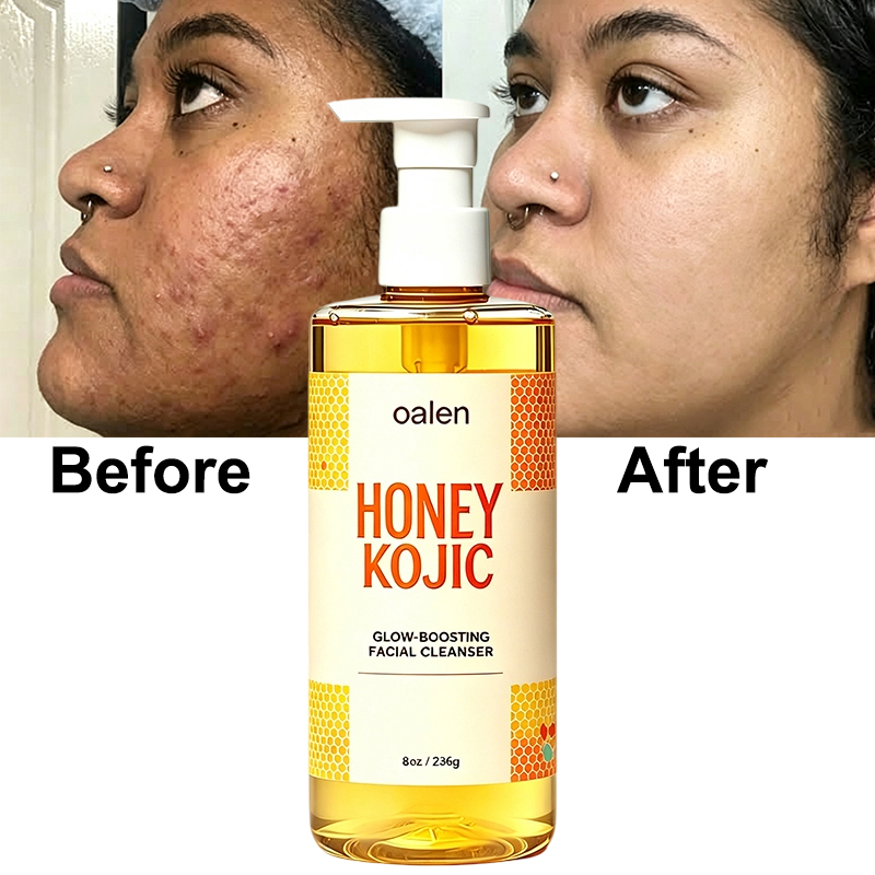 Oalen Private Label Honey Kojic Glow Boosting Facial Cleanser Remove Blackheads clear Blemishes Brighten Dull Skin Face Wash,MY SHOP