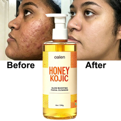 Oalen Private Label Honey Kojic Glow Boosting Facial Cleanser Remove Blackheads clear Blemishes Brighten Dull Skin Face Wash,MY SHOP