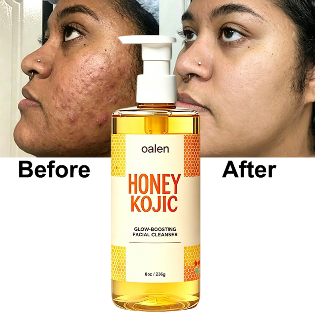 Oalen Private Label Honey Kojic Glow Boosting Facial Cleanser Remove Blackheads clear Blemishes Brighten Dull Skin Face Wash,MY SHOP
