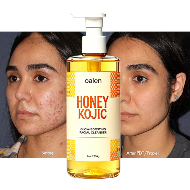 Oalen Private Label Honey Kojic Glow Boosting Facial Cleanser Remove Blackheads clear Blemishes Brighten Dull Skin Face Wash,MY SHOP