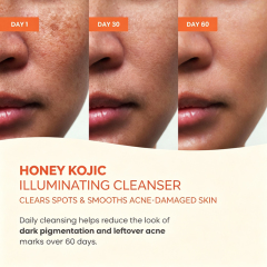 Oalen Private Label Honey Kojic Glow Boosting Facial Cleanser Remove Blackheads clear Blemishes Brighten Dull Skin Face Wash,MY SHOP