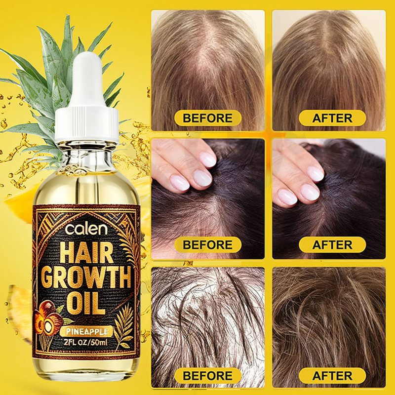 Luxfume Private Label Complete Chebe and Batana Oil Hair Care Set for Curly Hair Repair Dry Broken Over Processed Hair Growth,MY SHOP