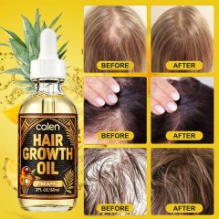 Luxfume Private Label Complete Chebe and Batana Oil Hair Care Set for Curly Hair Repair Dry Broken Over Processed Hair Growth,MY SHOP