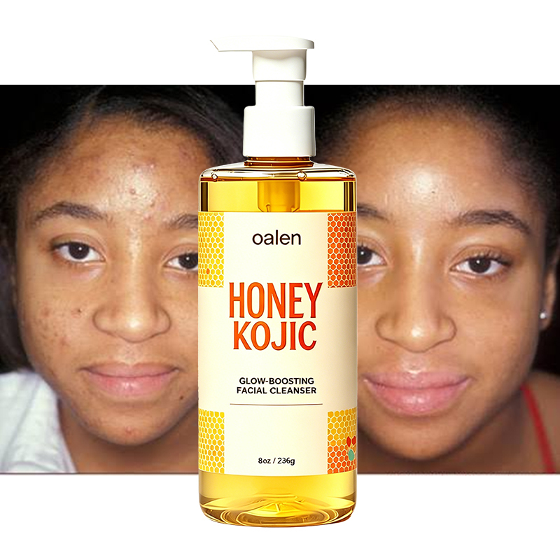 Oalen Private Label Honey Kojic Facial Wash Foaming Cleanser Fight Acne Reduce Blackheads Even Skin Tone Daily Face Care,MY SHOP