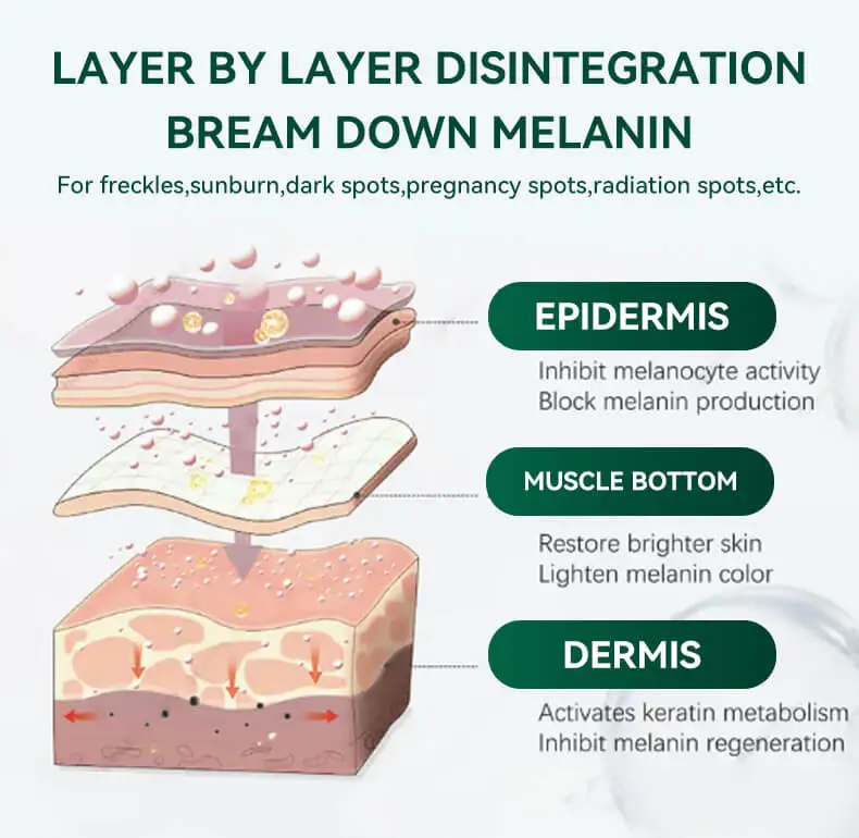 Freckles Removal serum Dark Spot Remover for Face Melasma Removal Depigmenting Melanin Correcting Facial Serum