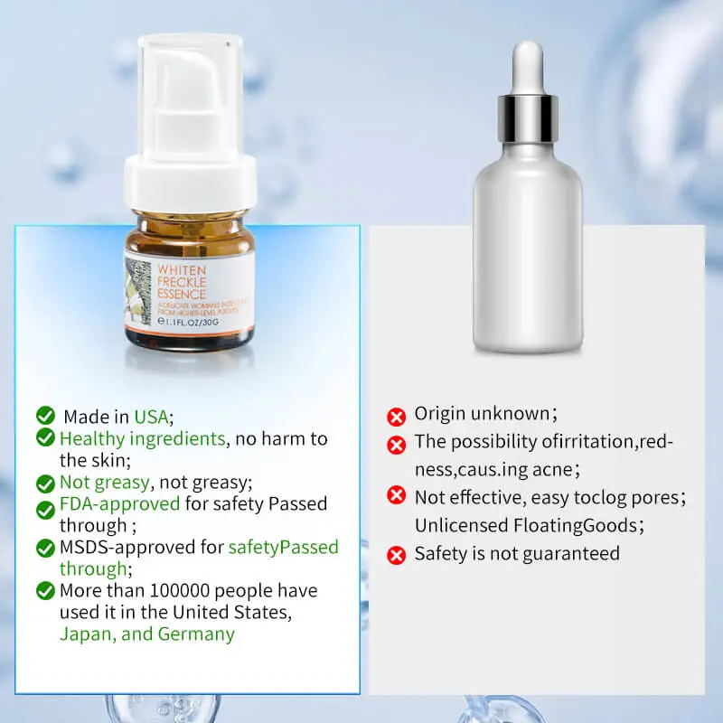 Freckles Removal serum Dark Spot Remover for Face Melasma Removal Depigmenting Melanin Correcting Facial Serum