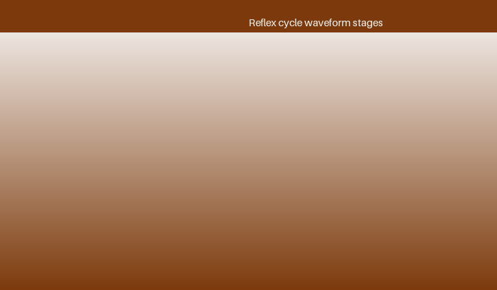 The Reflex waveform and its rationale
