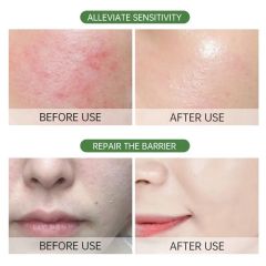 Aloe Vera Essence Moisturizing Anti Acne Deep Pore Cleansing Face Wash