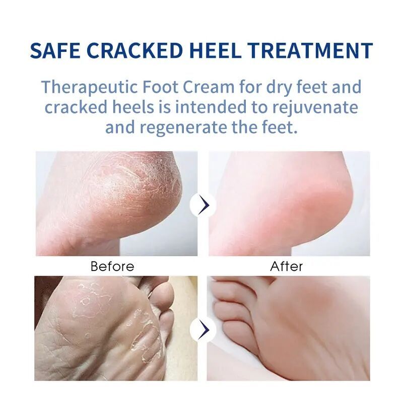 Anti-cracking Deeply Moisturizing & Nourishing Care Foot Cream